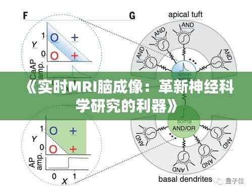 《实时MRI脑成像：革新神经科学研究的利器》