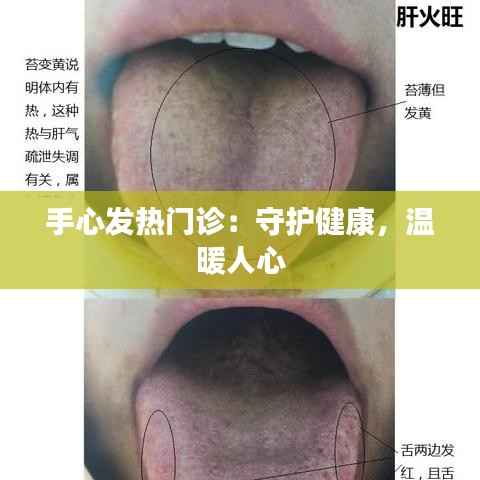 手心发热门诊:守护健康,温暖人心