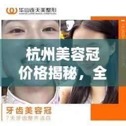 杭州美容冠价格揭秘,全方位牙齿美容信息指南