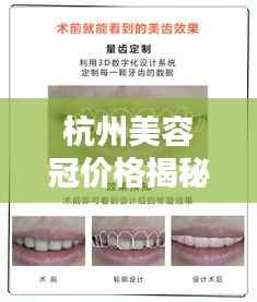 杭州美容冠价格揭秘,全方位牙齿美容信息指南