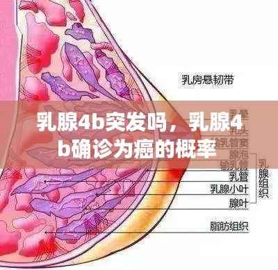 乳腺4b突发吗,乳腺4b确诊为癌的概率