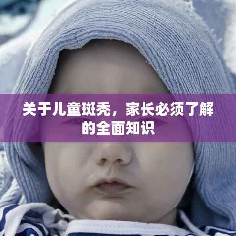 关于儿童斑秃,家长必须了解的全面知识