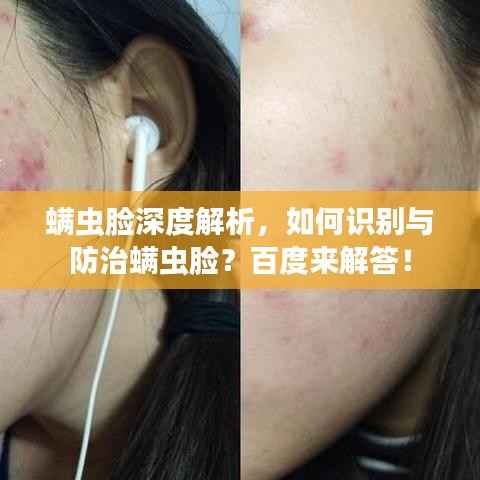 螨虫脸深度解析,如何识别与防治螨虫脸?百度来解答!