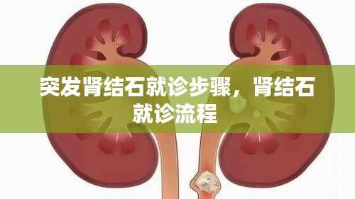 突发肾结石就诊步骤，肾结石就诊流程 