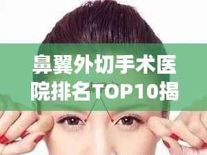鼻翼外切手术医院排名TOP10揭秘,专业医美机构权威榜单