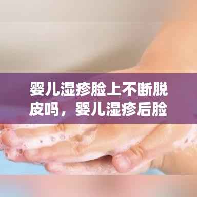 婴儿湿疹脸上不断脱皮吗，婴儿湿疹后脸上蜕皮粗糙 