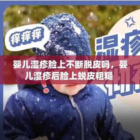 婴儿湿疹脸上不断脱皮吗,婴儿湿疹后脸上蜕皮粗糙