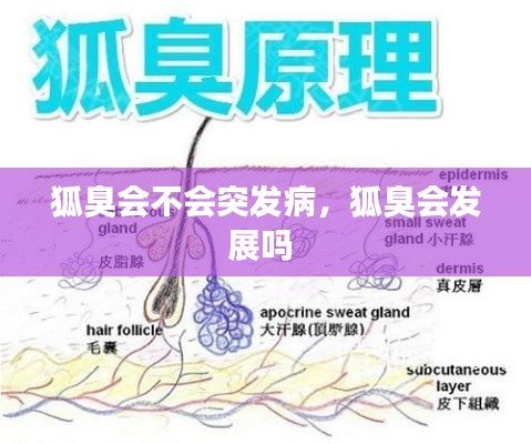 狐臭会不会突发病,狐臭会发展吗