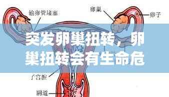 突发卵巢扭转,卵巢扭转会有生命危险吗