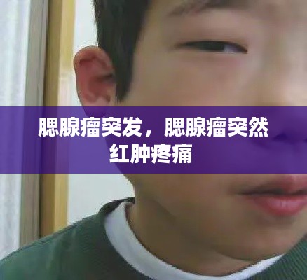 腮腺瘤突发,腮腺瘤突然红肿疼痛