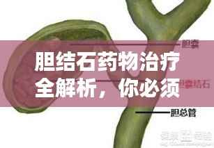 胆结石药物治疗全解析,你必须了解的知识